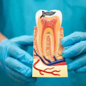 Child Root Canal Treatment