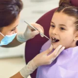 Tooth-Colored Fillings